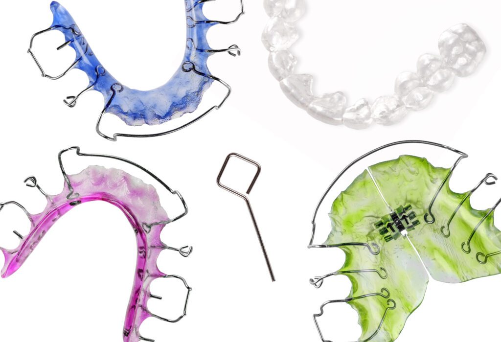 Retention - MyOrthodontist - retention,Bayonne orthodontist retention